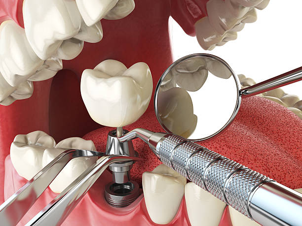 Best Emergency Dental Surgery in Sullivan, IL