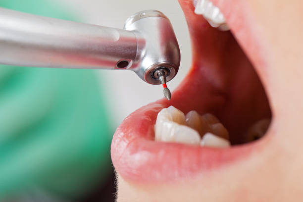 Best Emergency Treatment for Toothache in Sullivan, IL